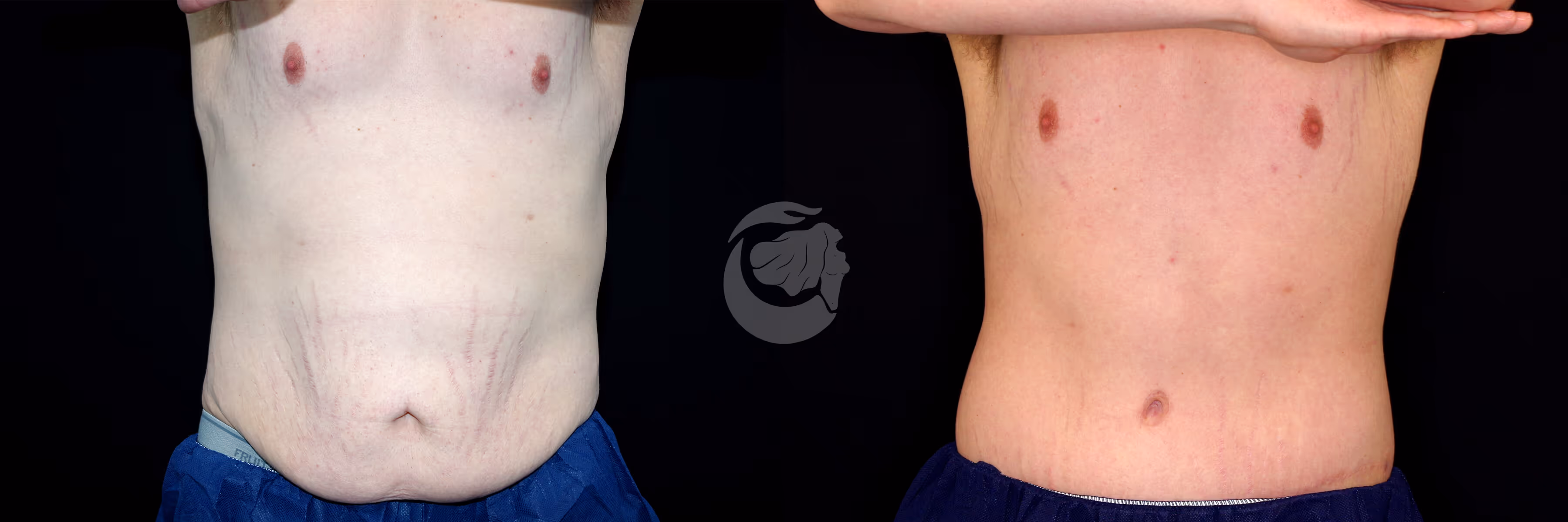 Before And After Patient Image