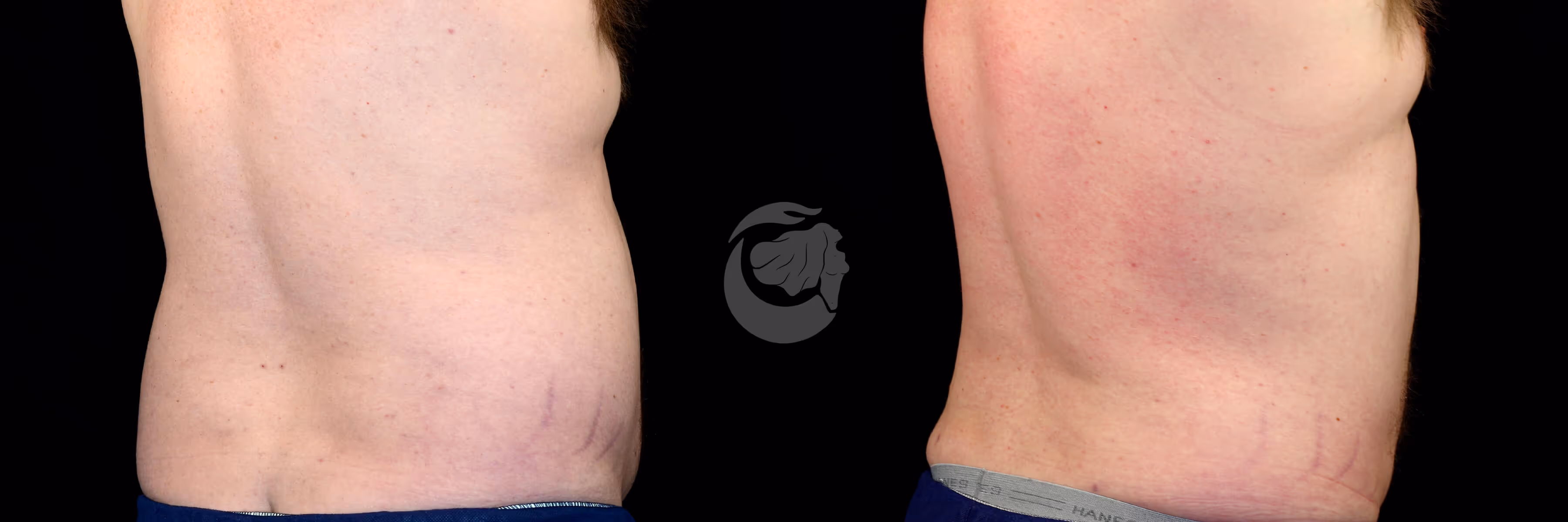 Before And After Patient Image