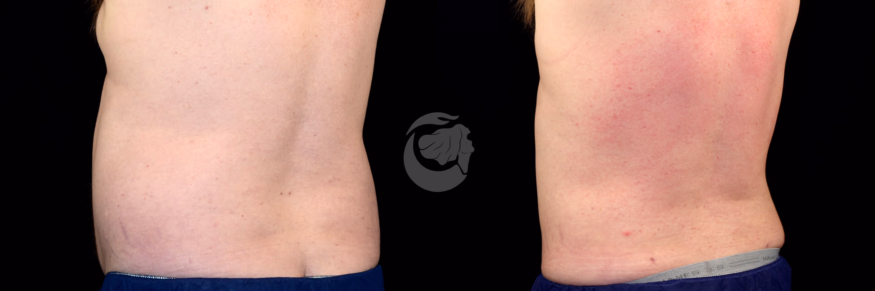 Before And After Patient Image