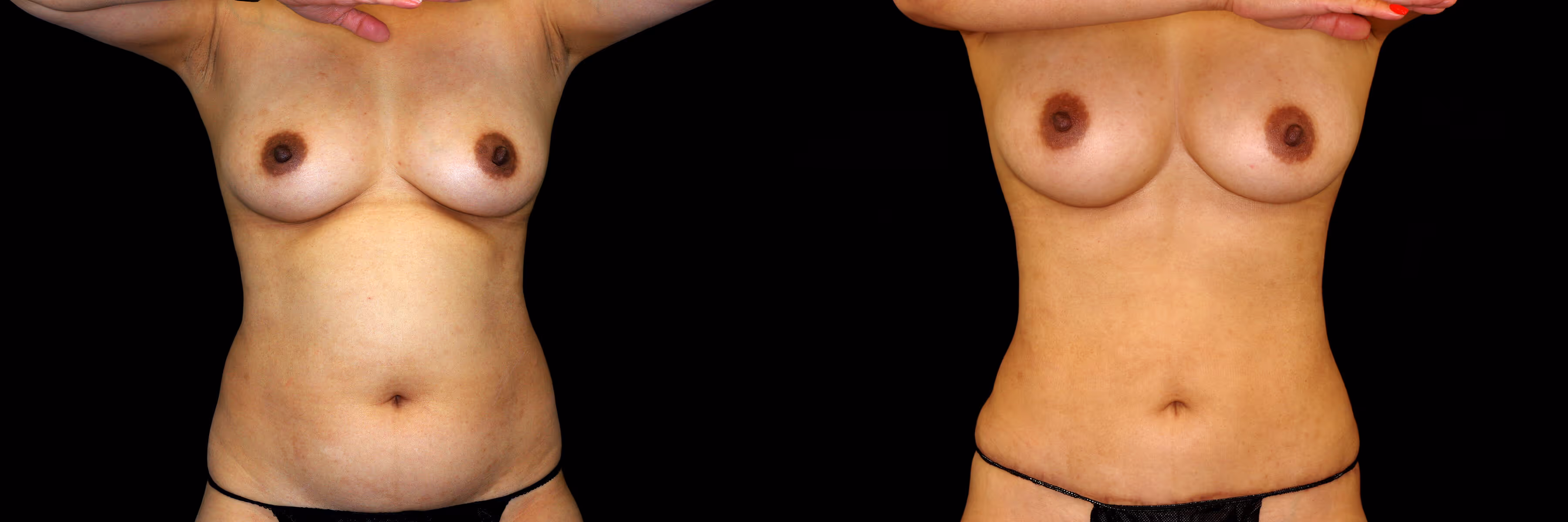 Before And After Patient Image
