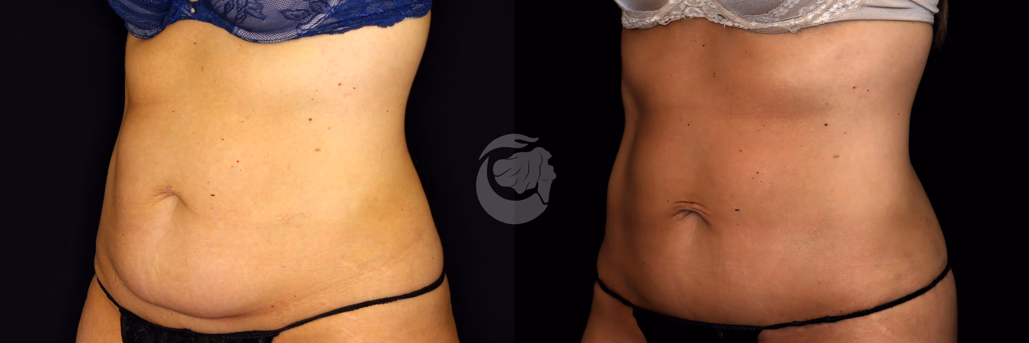 Before And After Patient Image