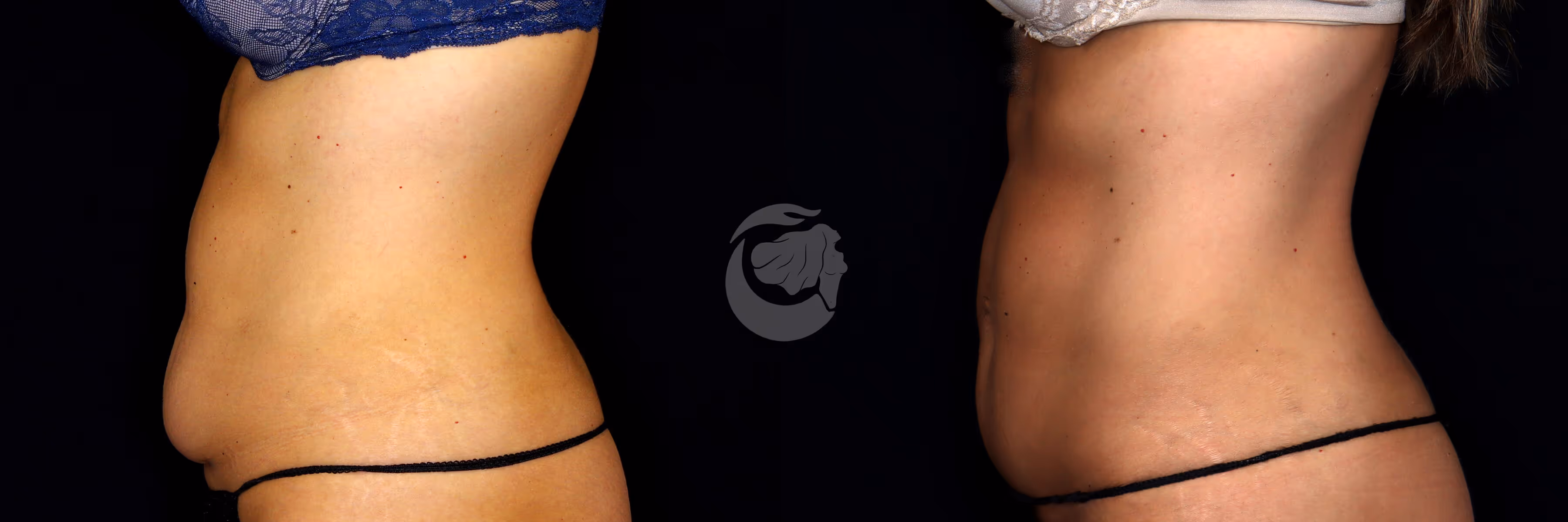 Before And After Patient Image