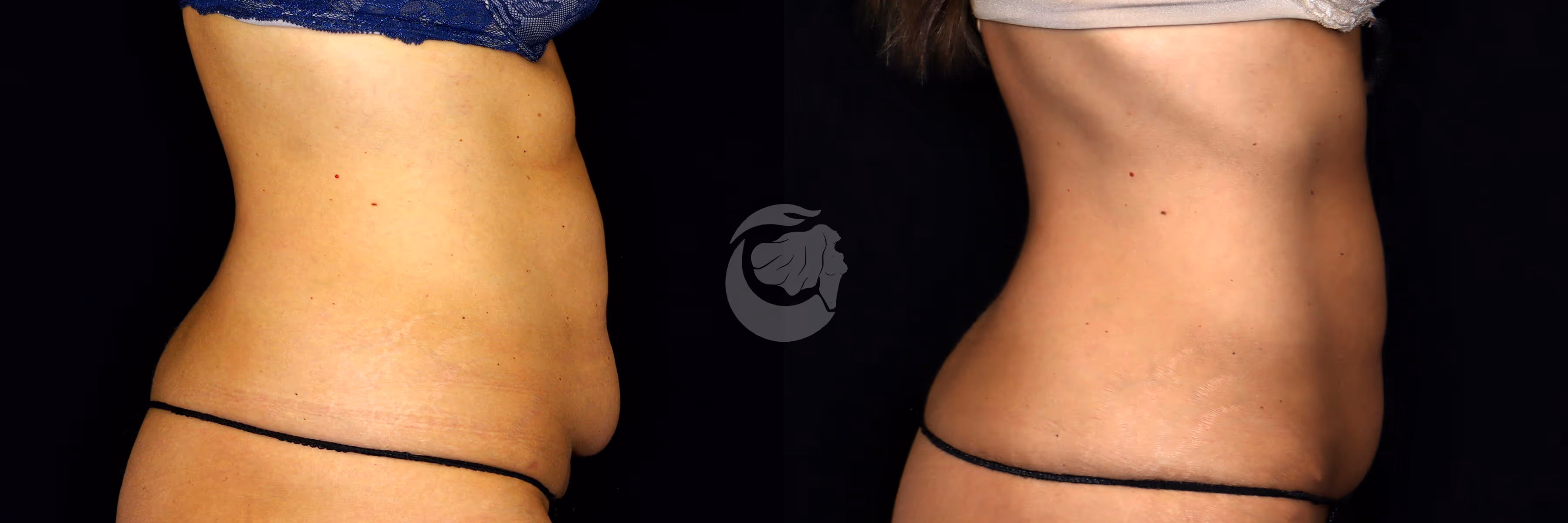 Before And After Patient Image