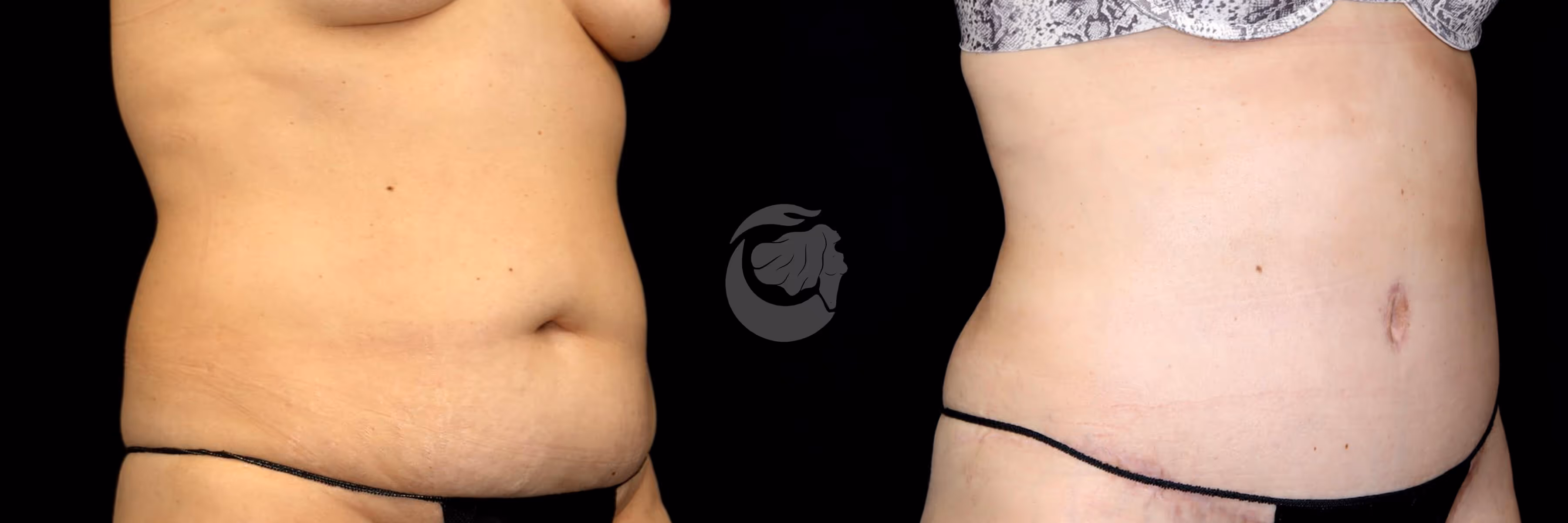 Before And After Patient Image