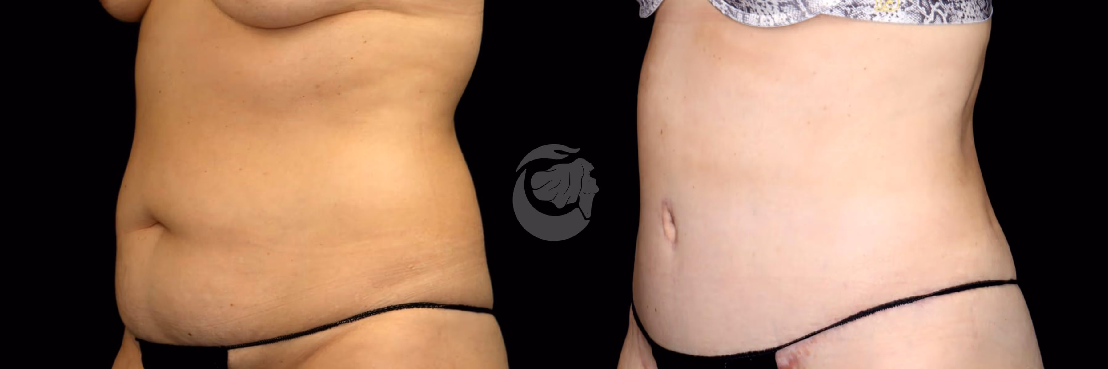 Before And After Patient Image