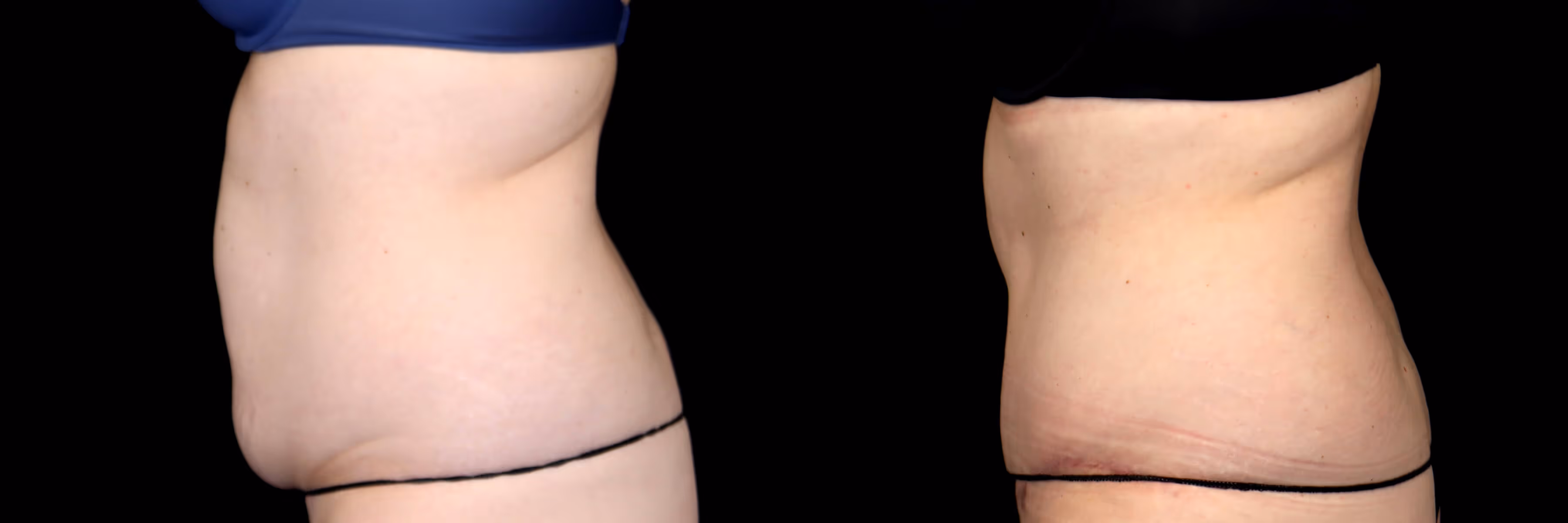 Before And After Patient Image