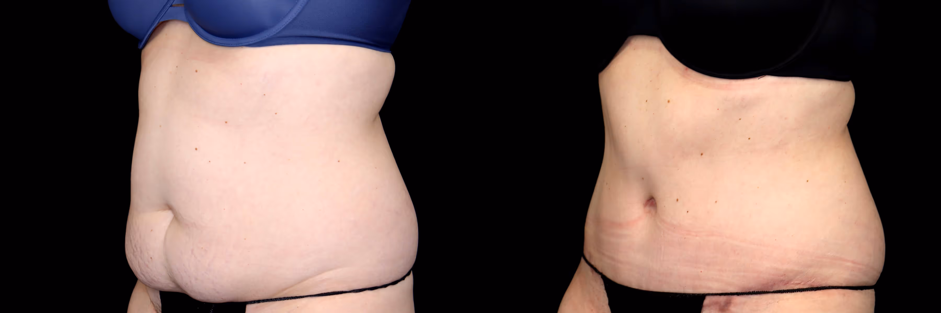 Before And After Patient Image