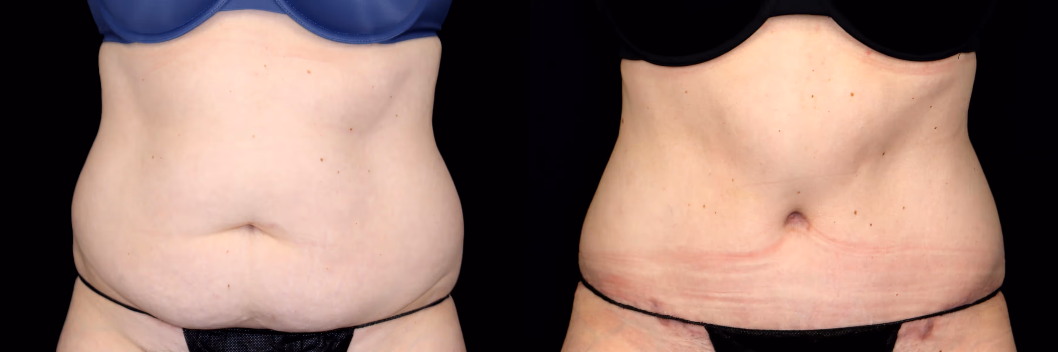 Before And After Patient Image