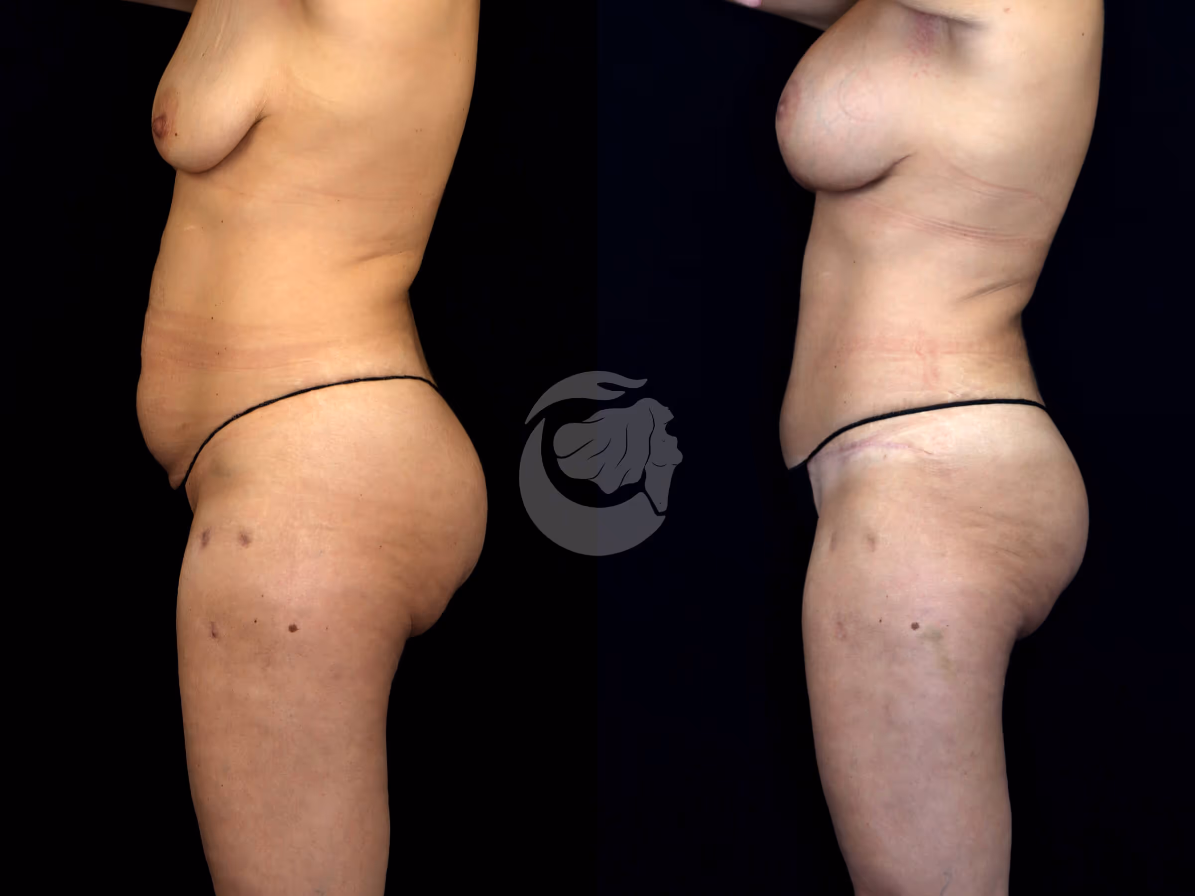 Before And After Patient Image