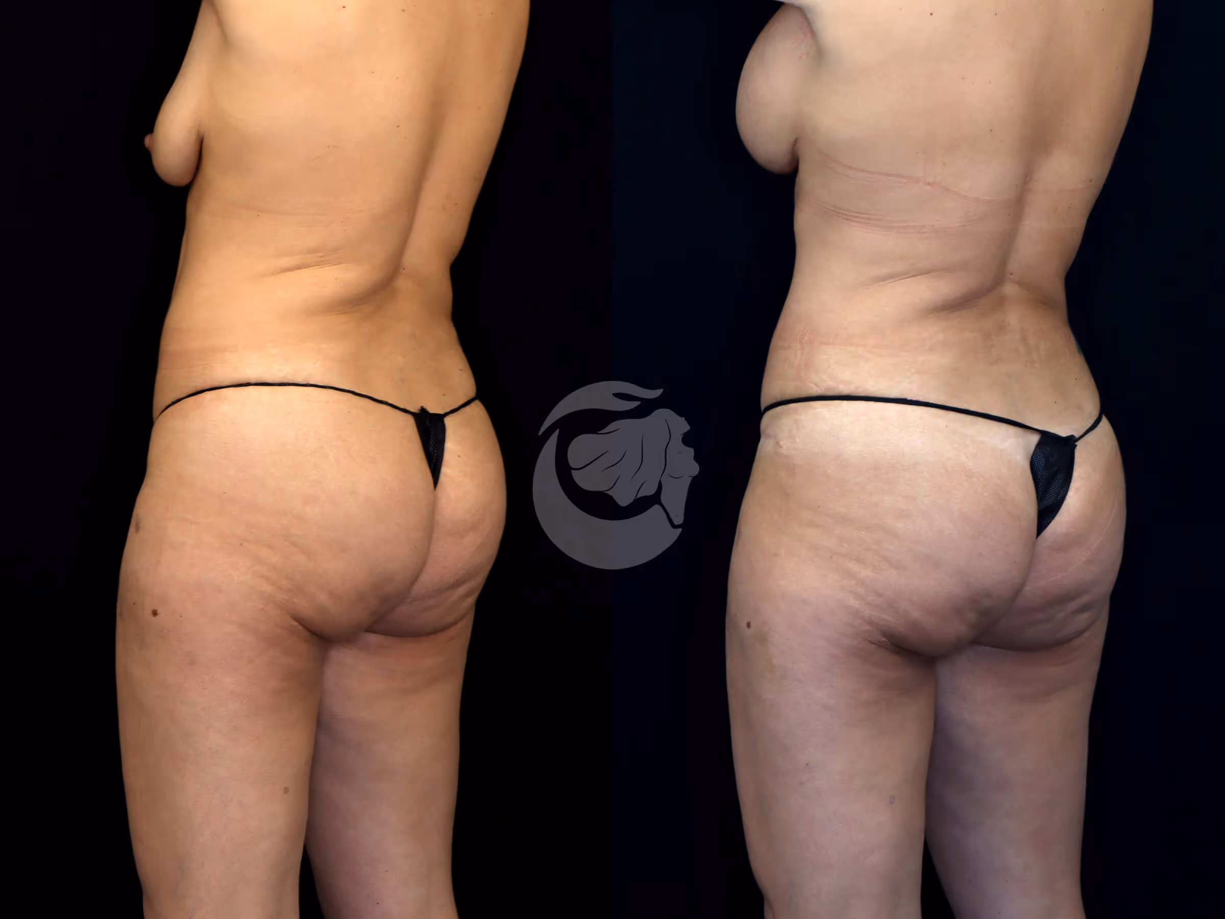 Before And After Patient Image