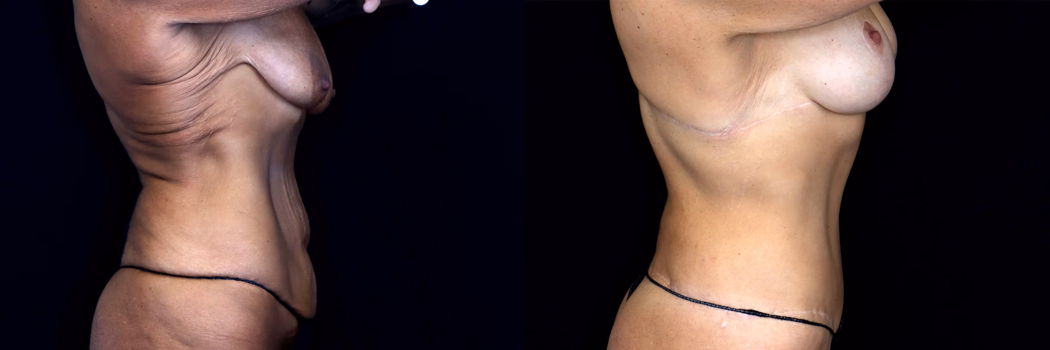 Before And After Patient Image