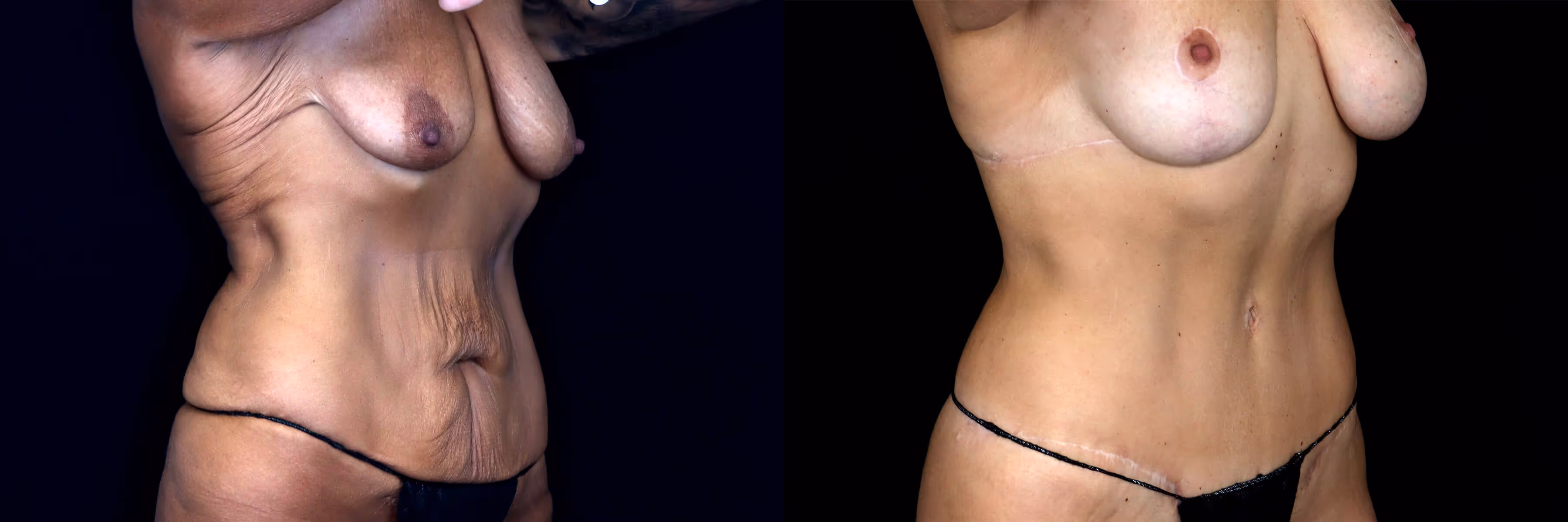 Before And After Patient Image