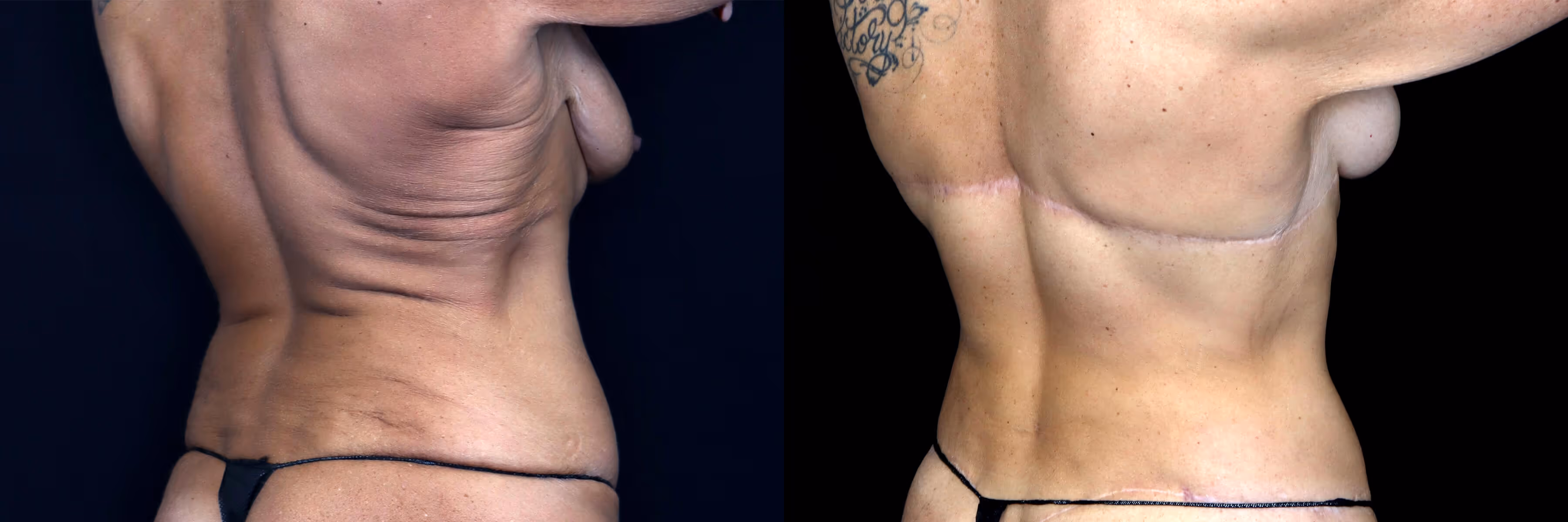 Before And After Patient Image