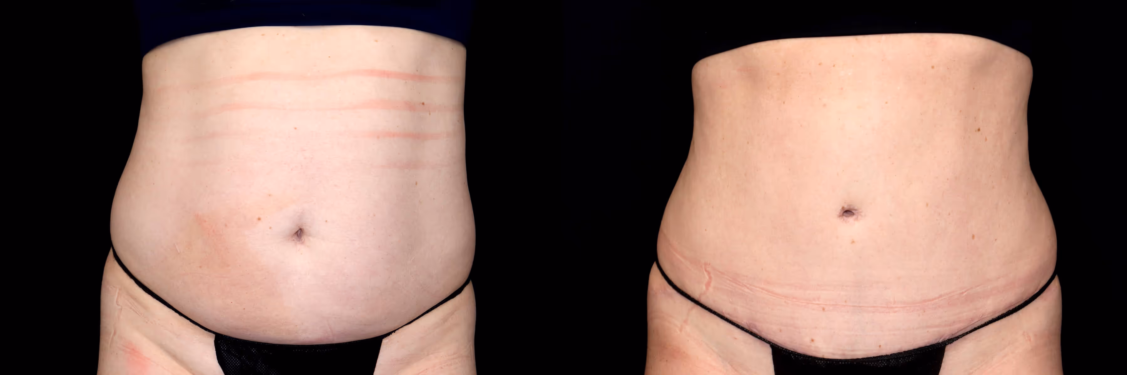Before And After Patient Image