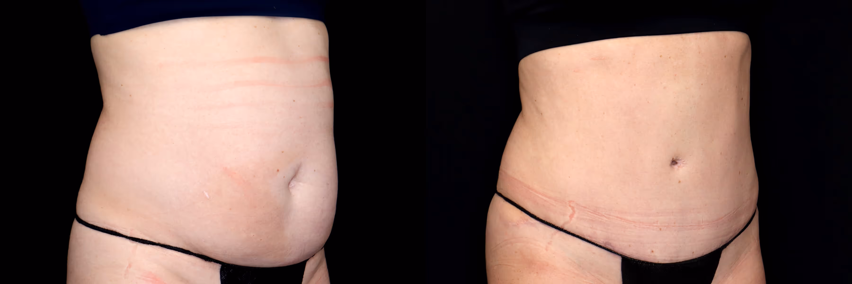 Before And After Patient Image