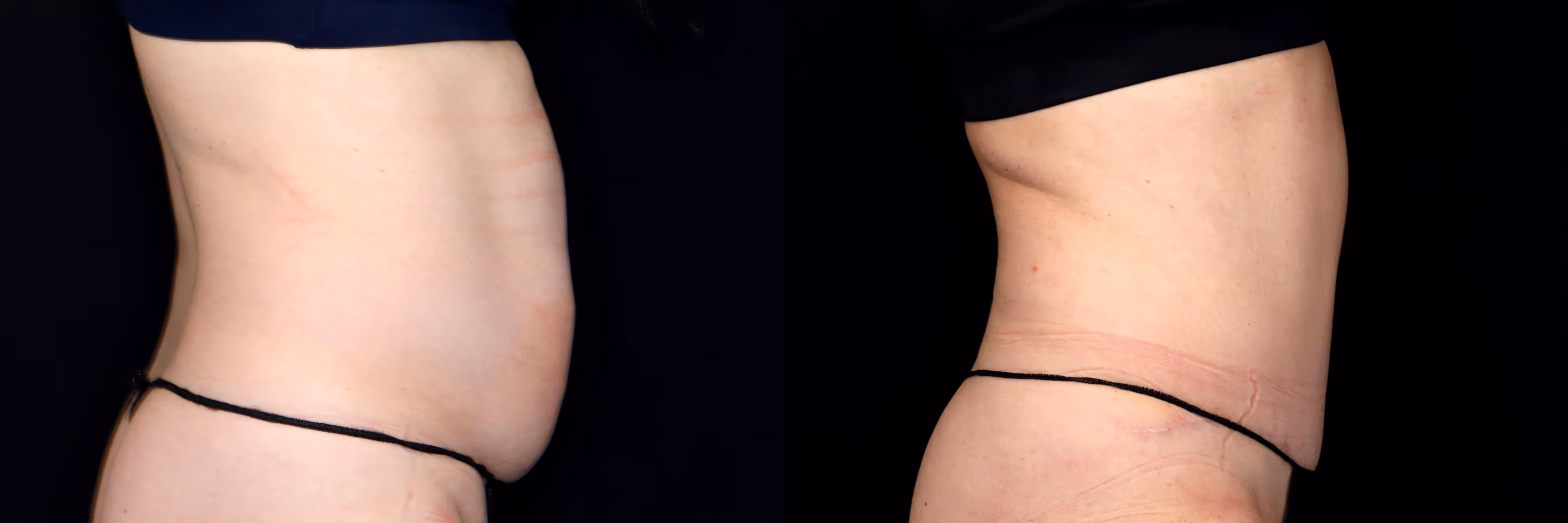 Before And After Patient Image
