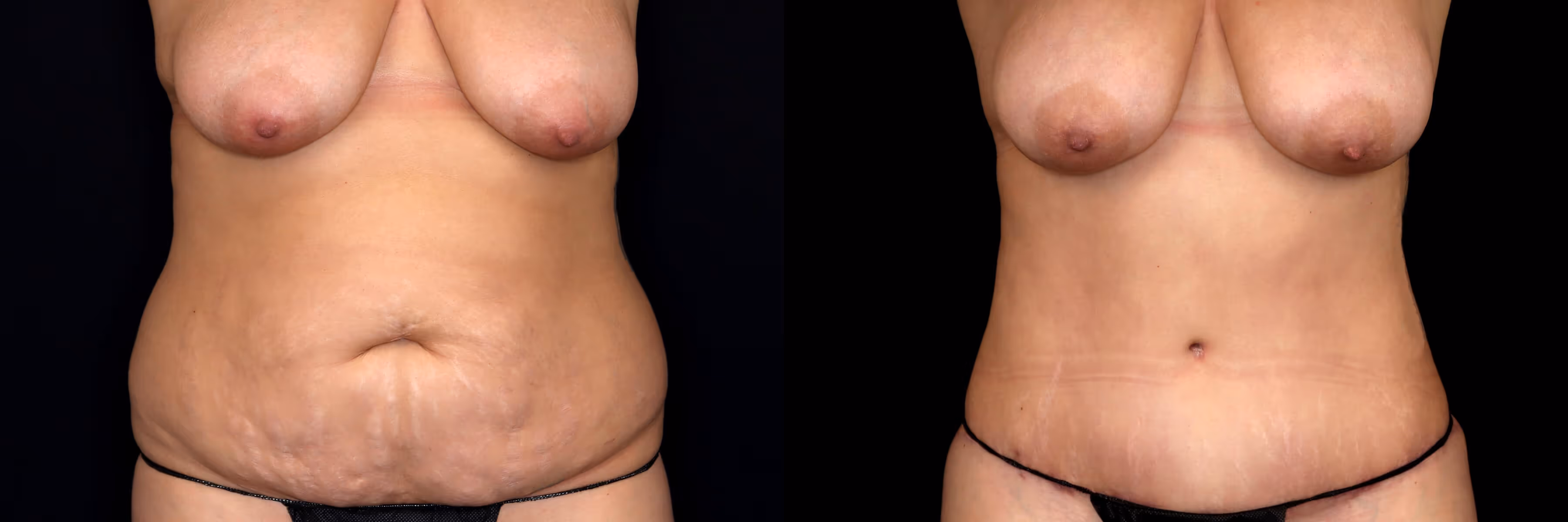 Before And After Patient Image