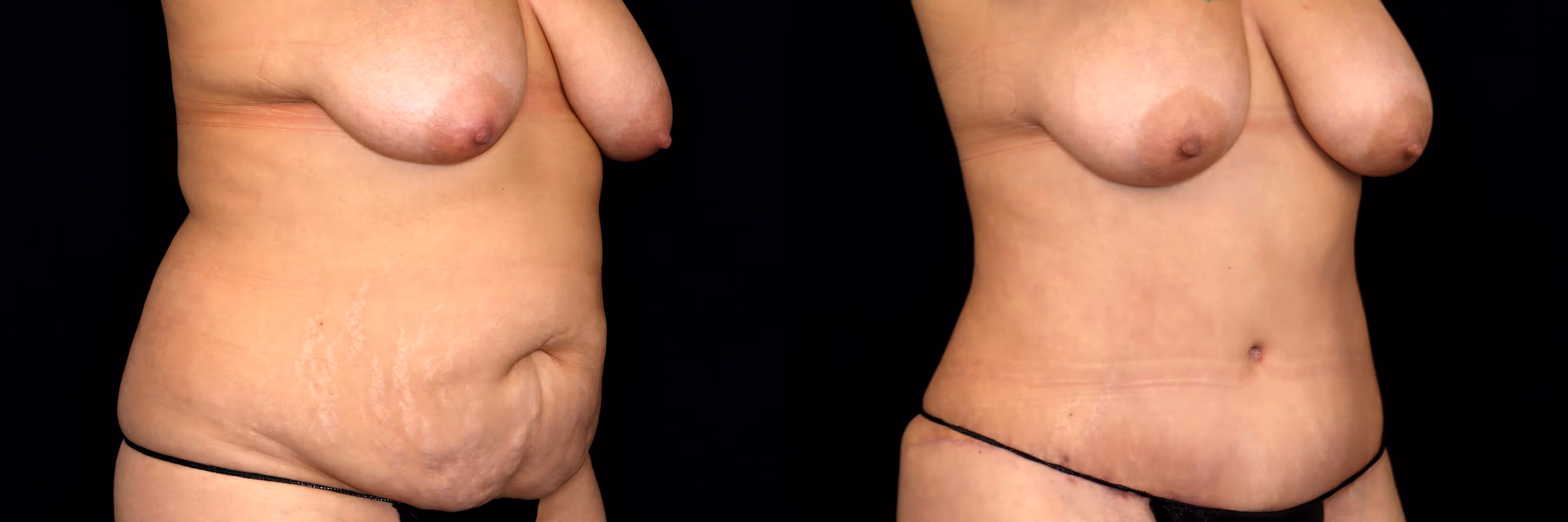 Before And After Patient Image