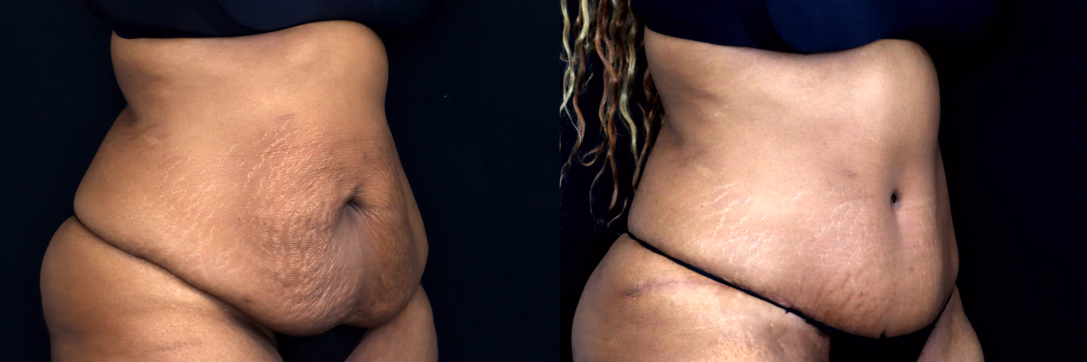 Before And After Patient Image