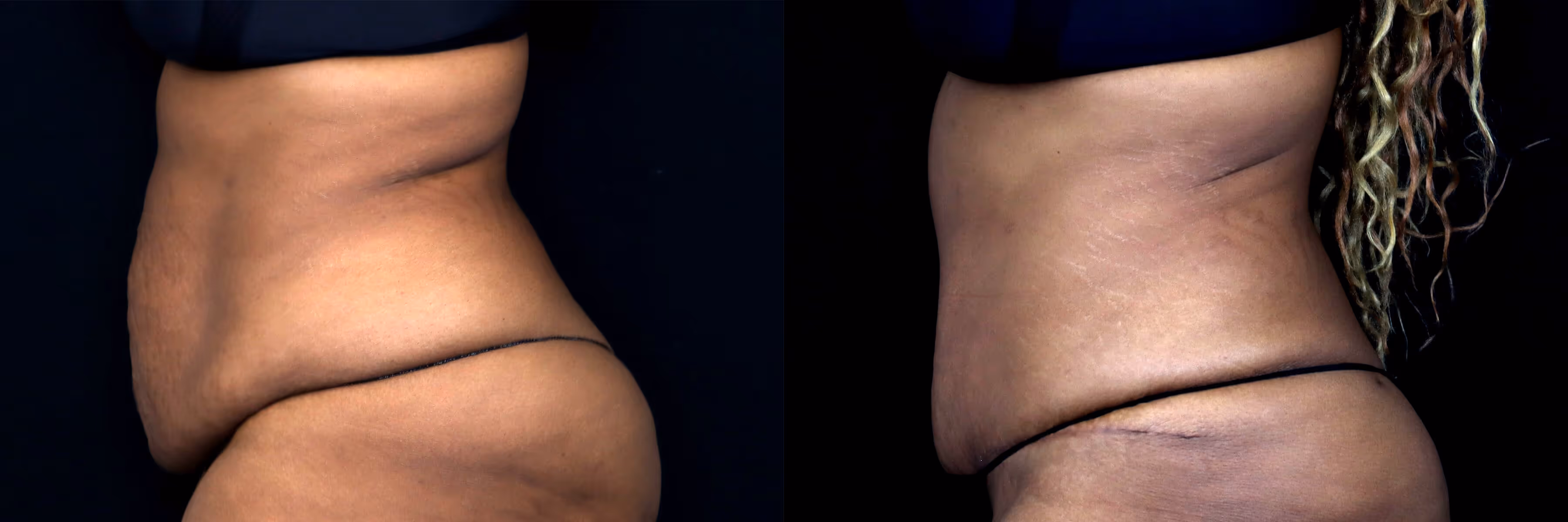 Before And After Patient Image