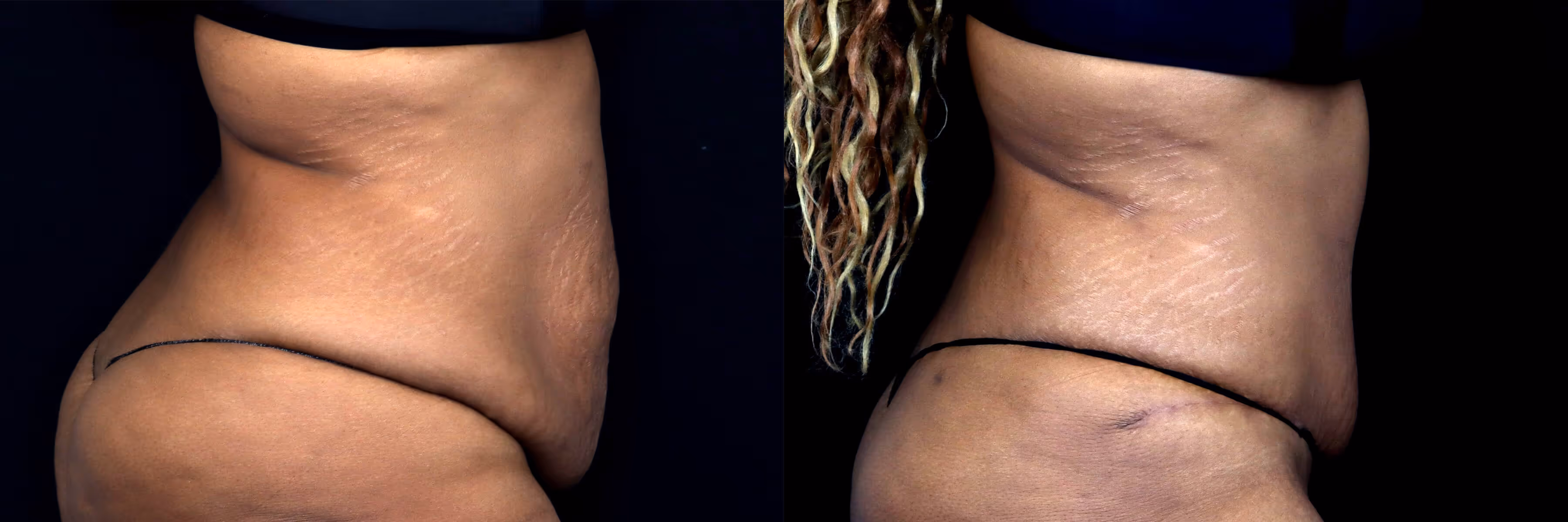 Before And After Patient Image