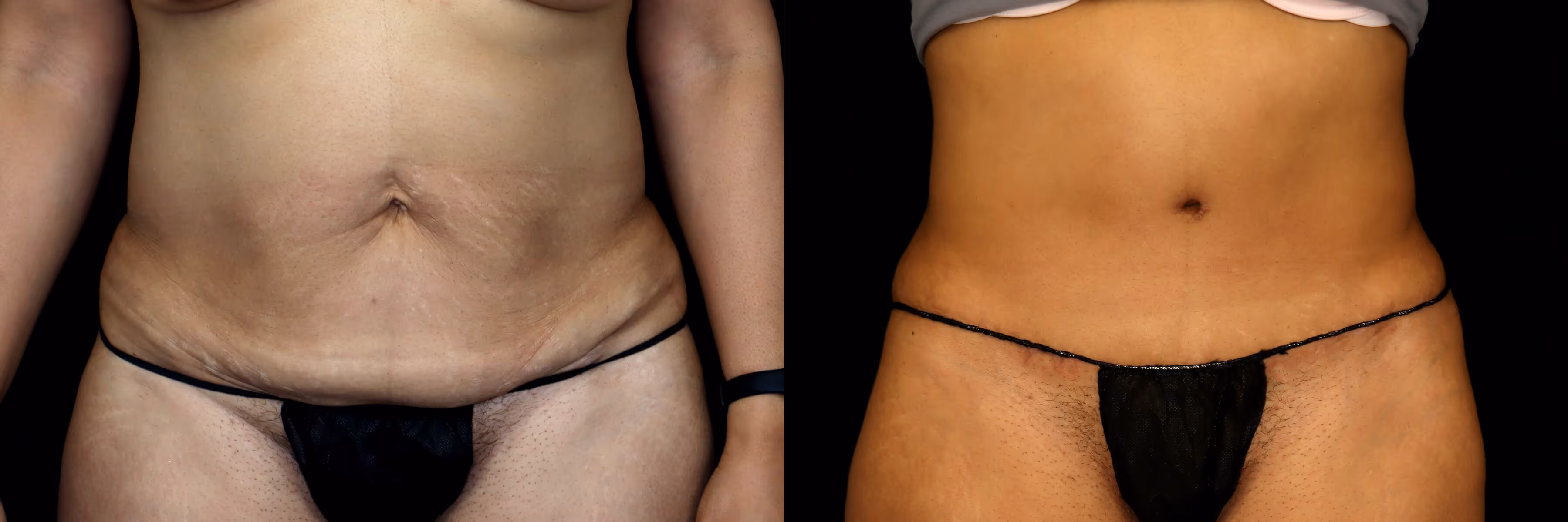 Before And After Patient Image
