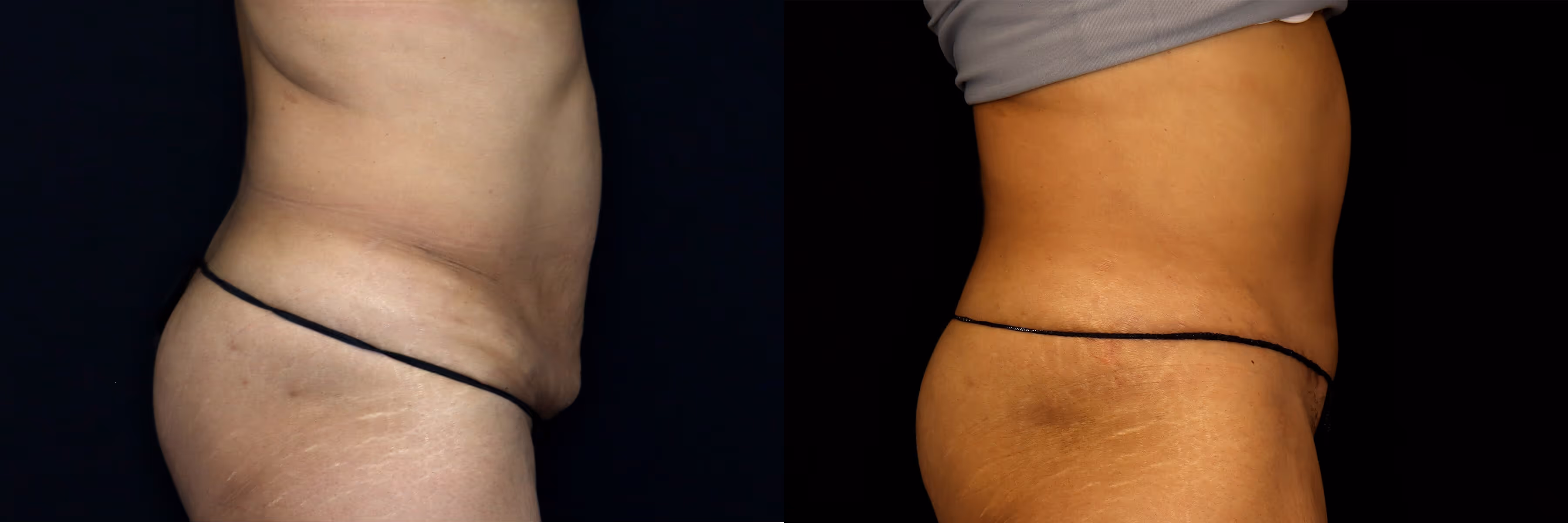 Before And After Patient Image