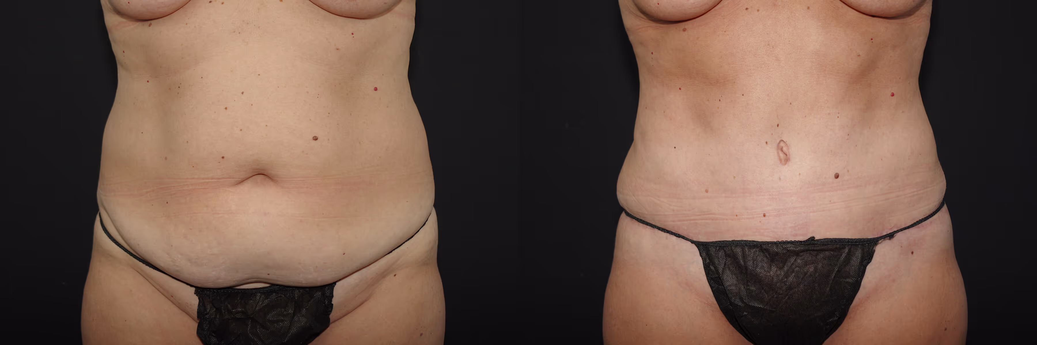 Before And After Patient Image