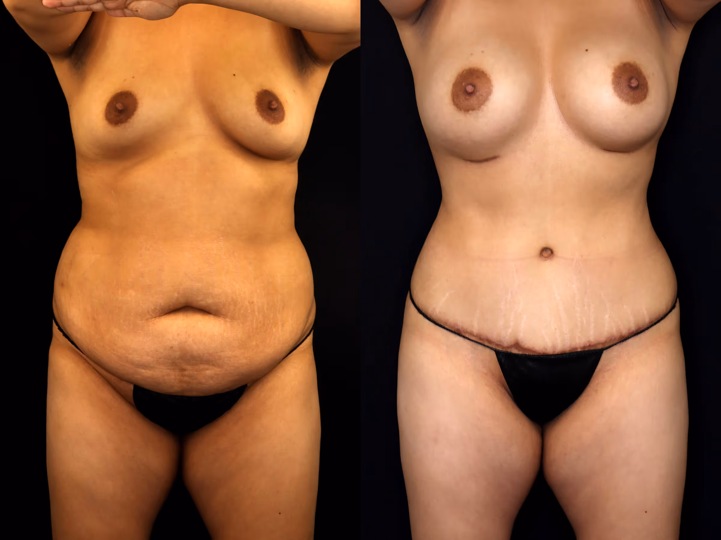 Before And After Patient Image