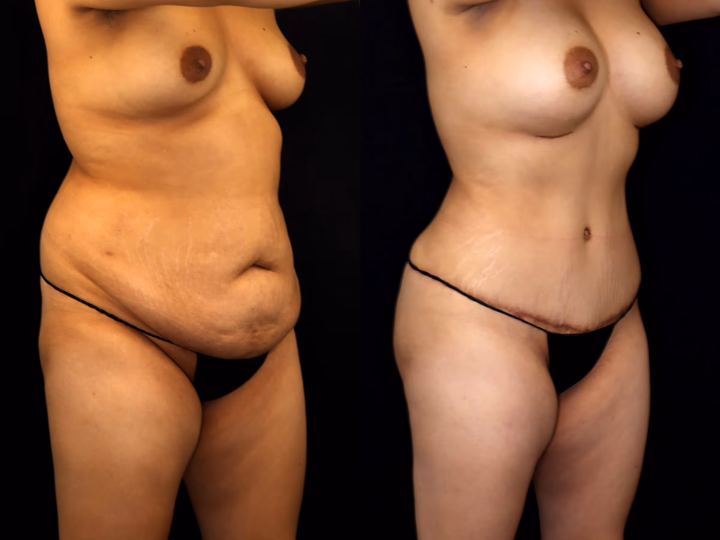 Before And After Patient Image