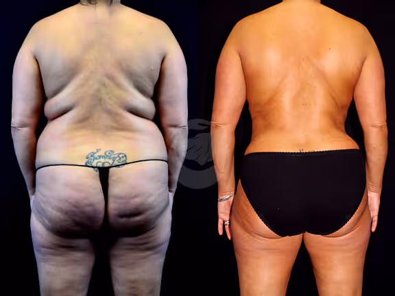 Before And After Patient Image
