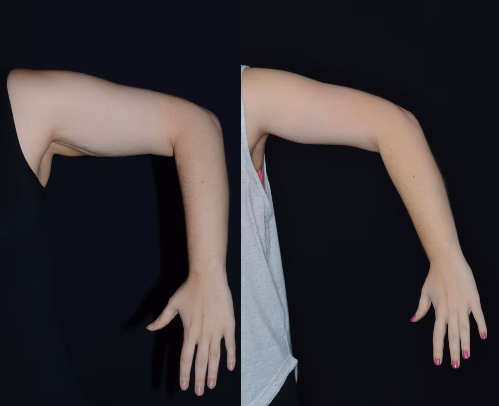 Before And After Patient Image
