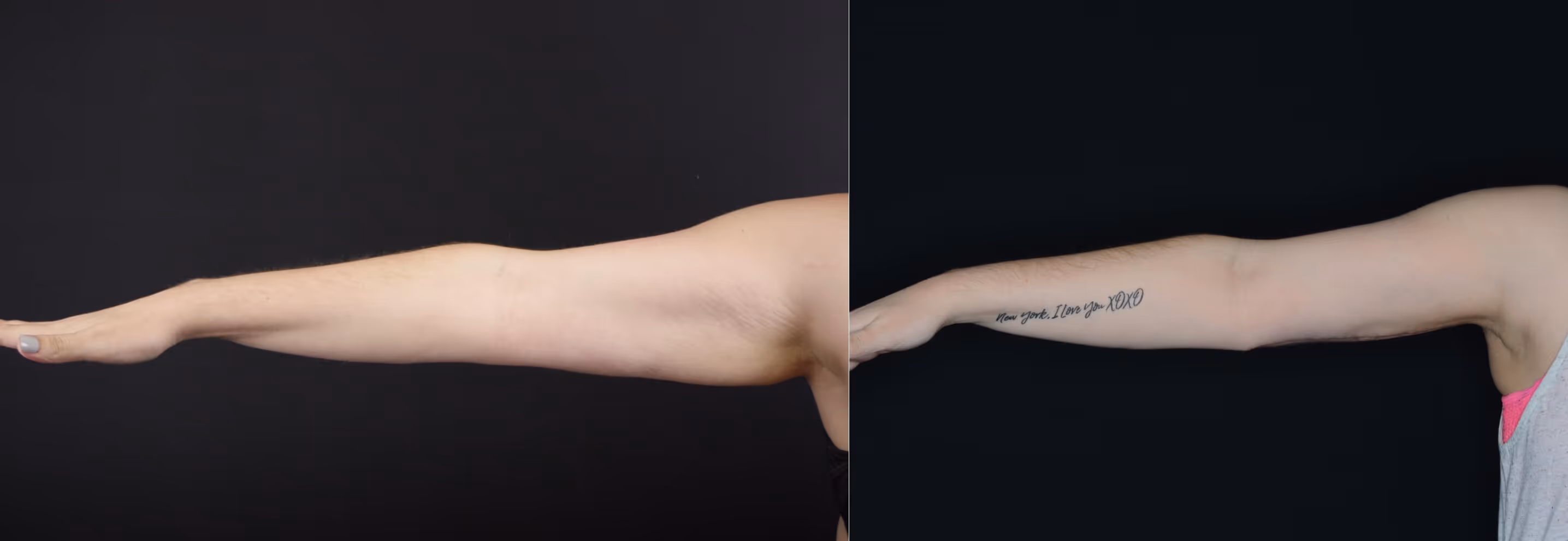 Before And After Patient Image