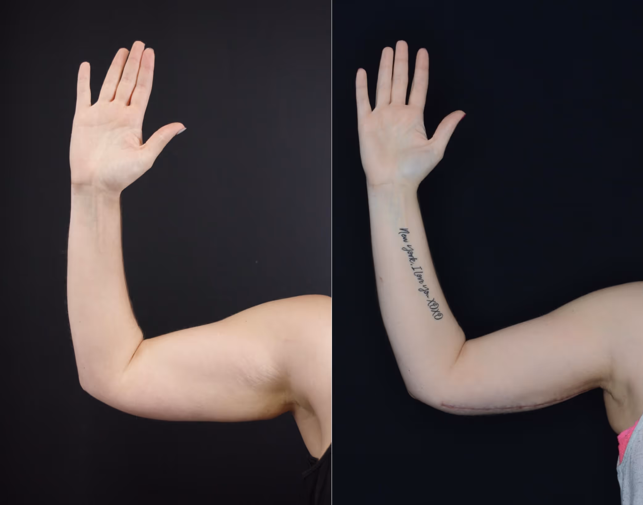 Before And After Patient Image