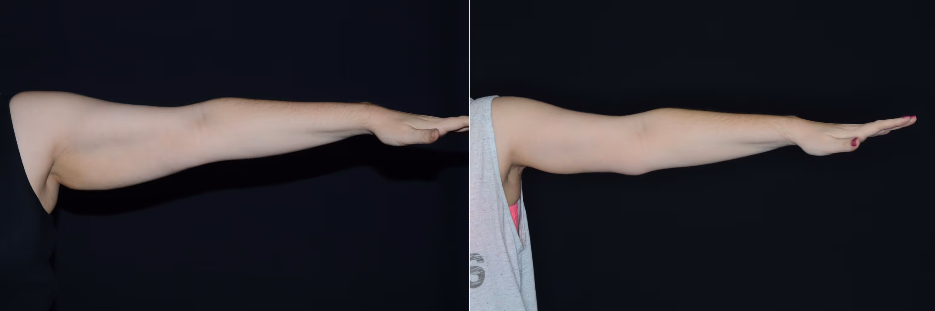 Before And After Patient Image
