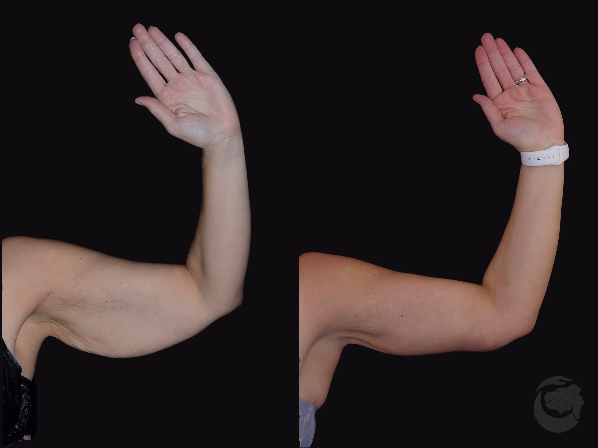Before And After Patient Image