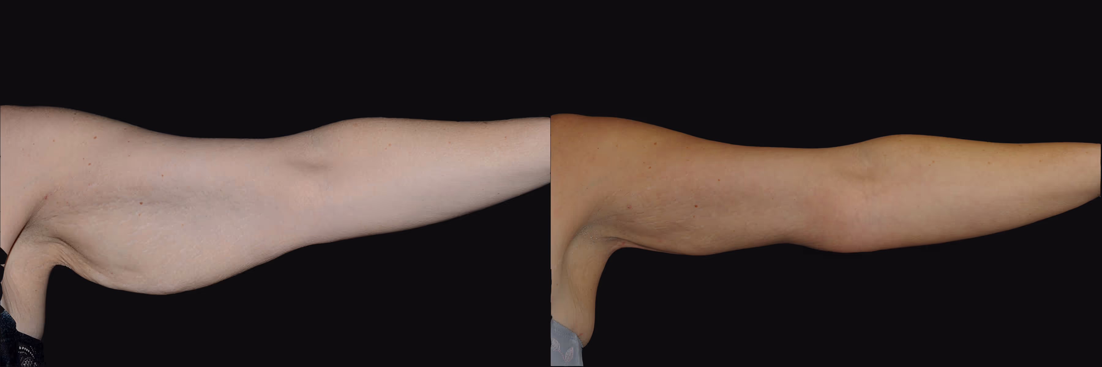 Before And After Patient Image