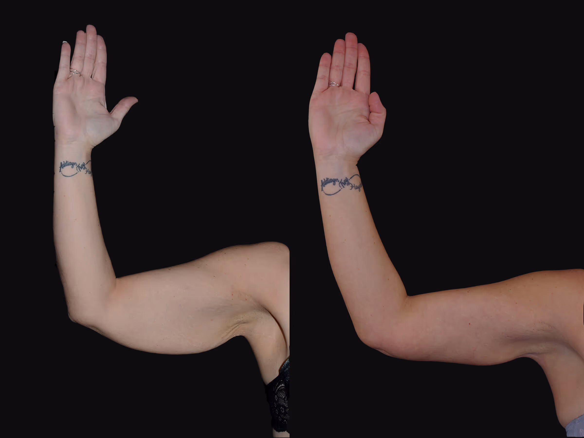 Before And After Patient Image
