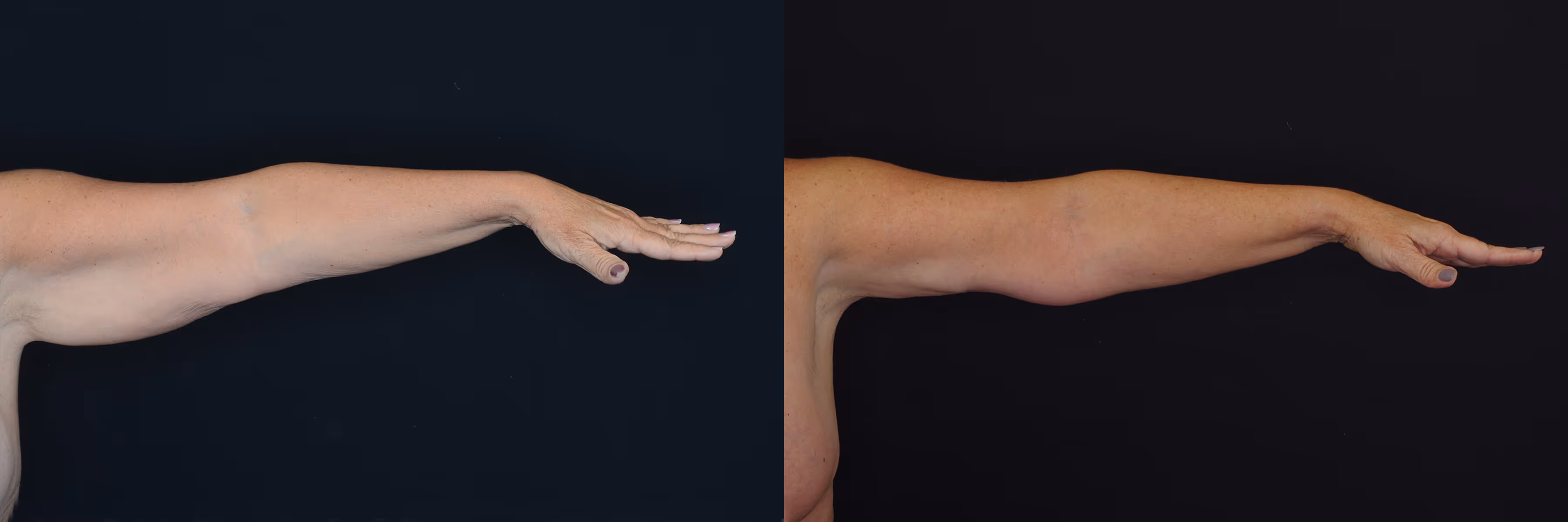 Before And After Patient Image
