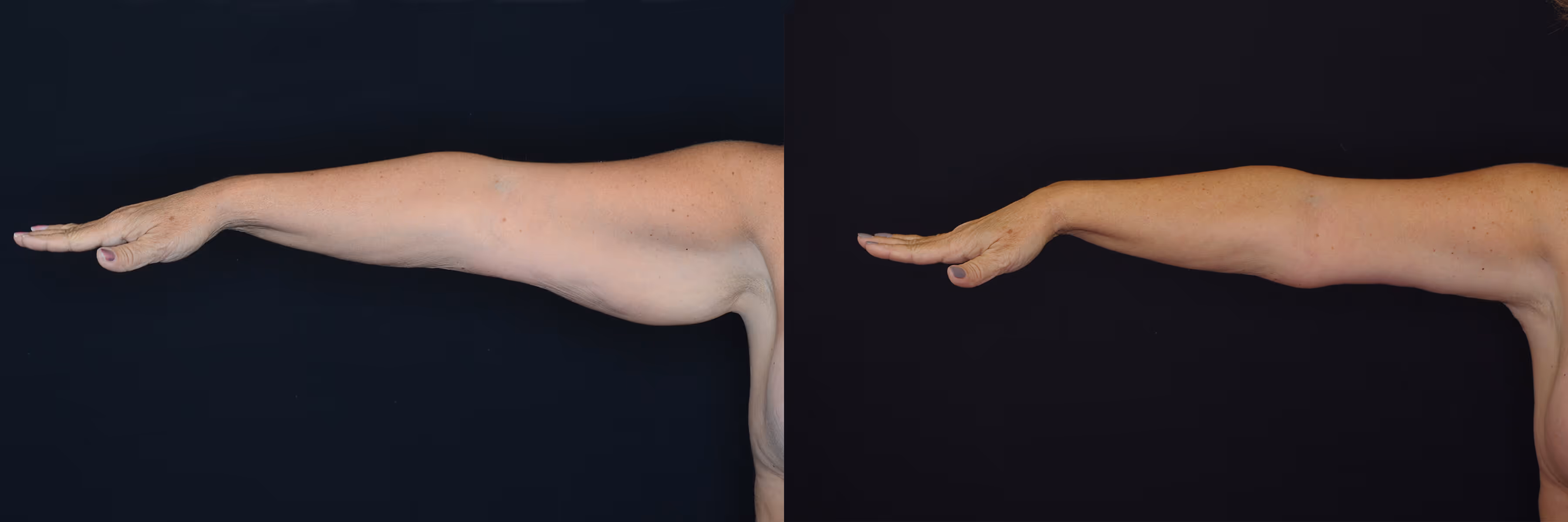 Before And After Patient Image
