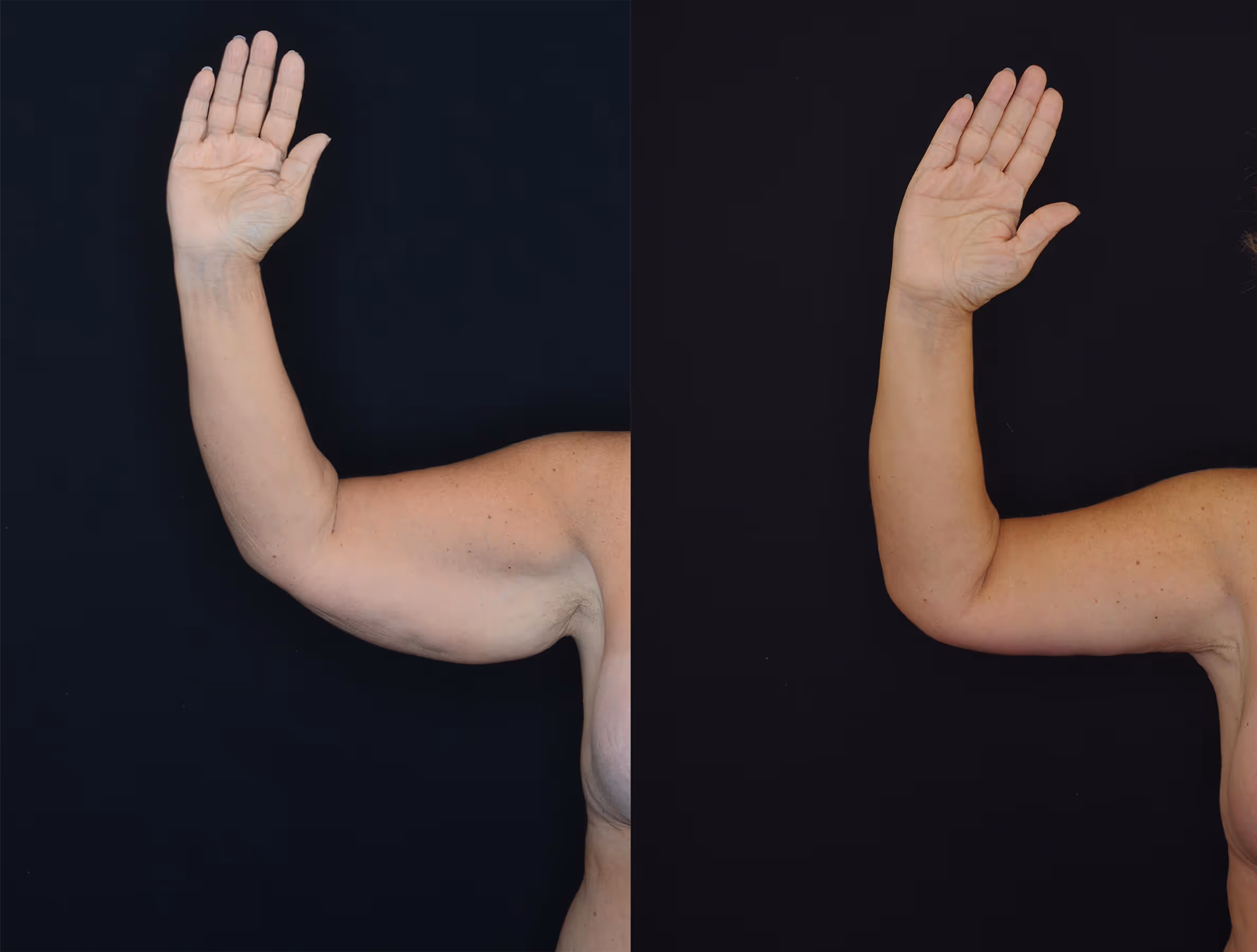 Before And After Patient Image