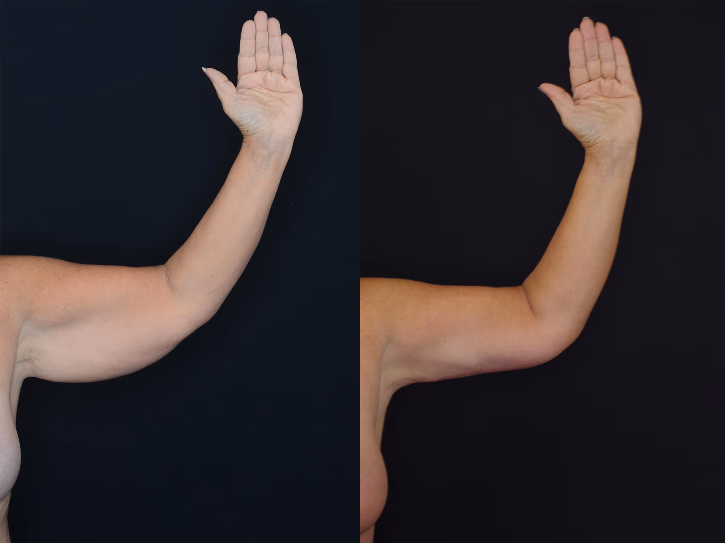 Before And After Patient Image