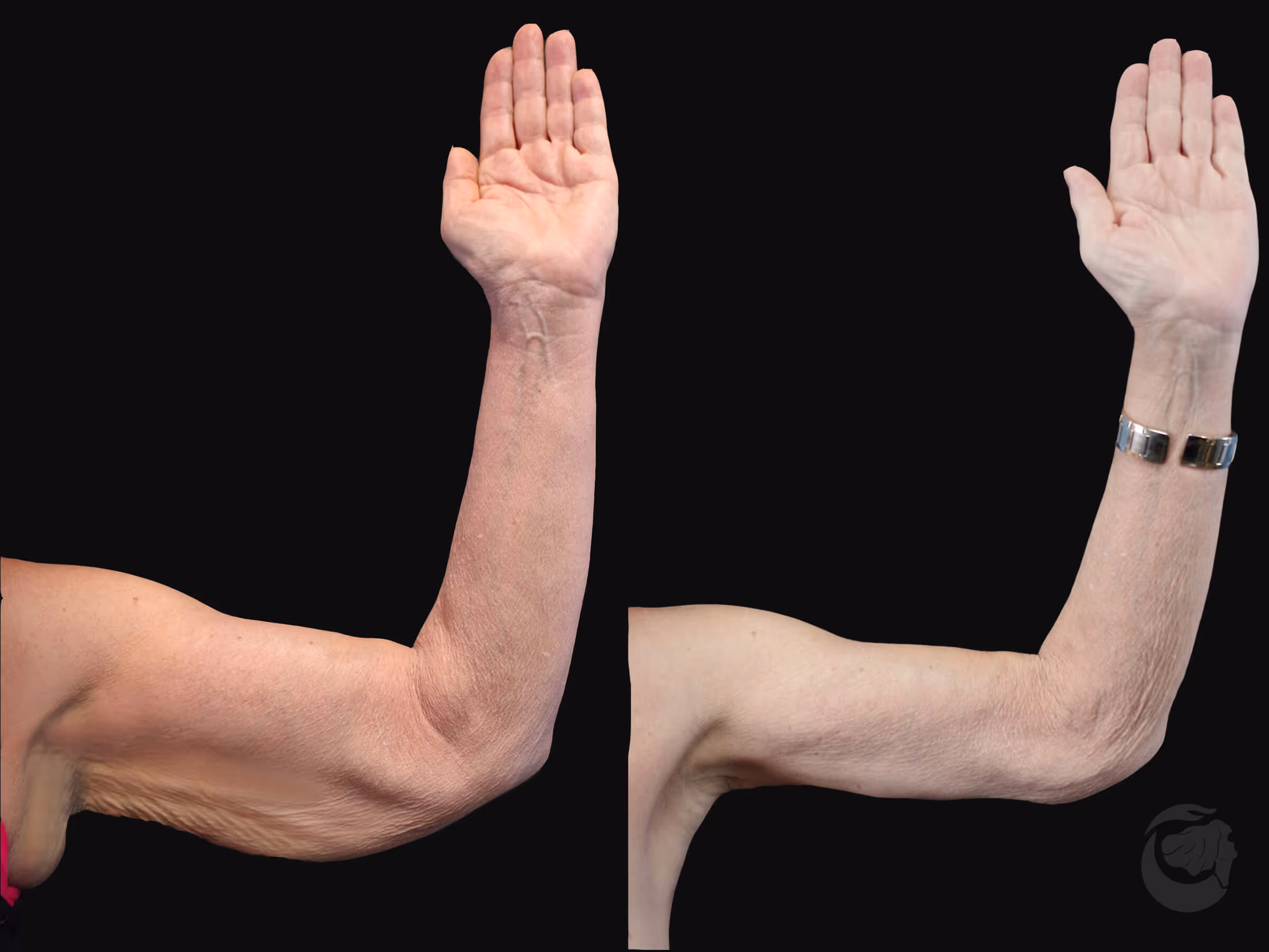 Before And After Patient Image
