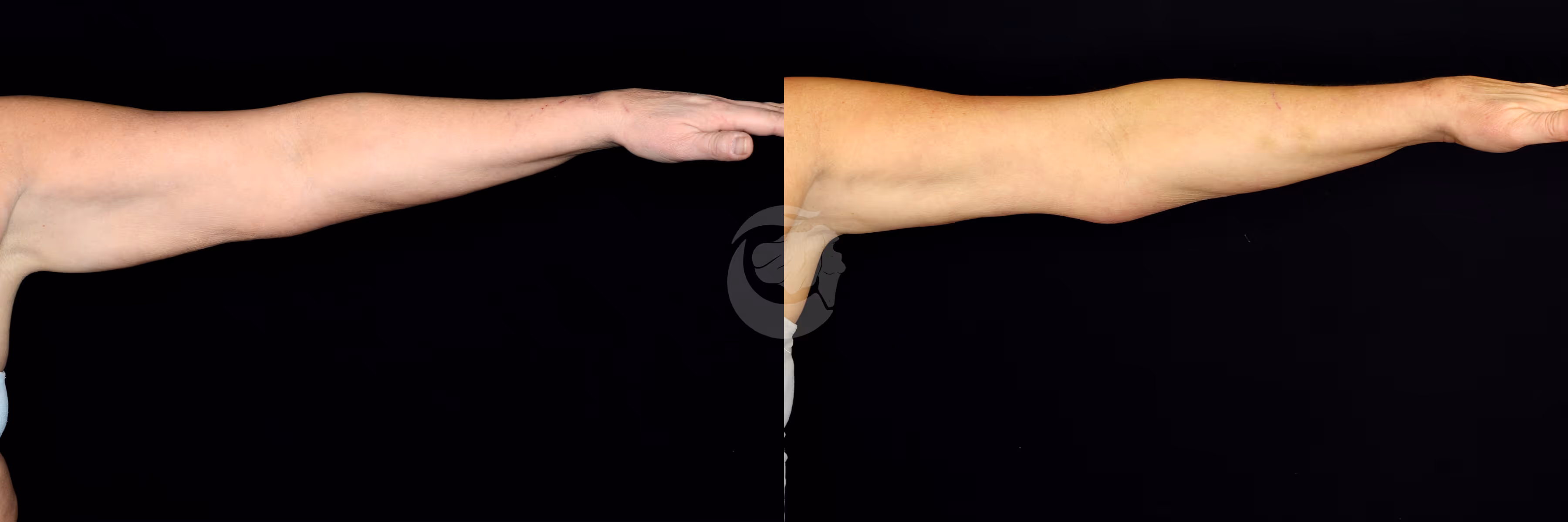 Before And After Patient Image
