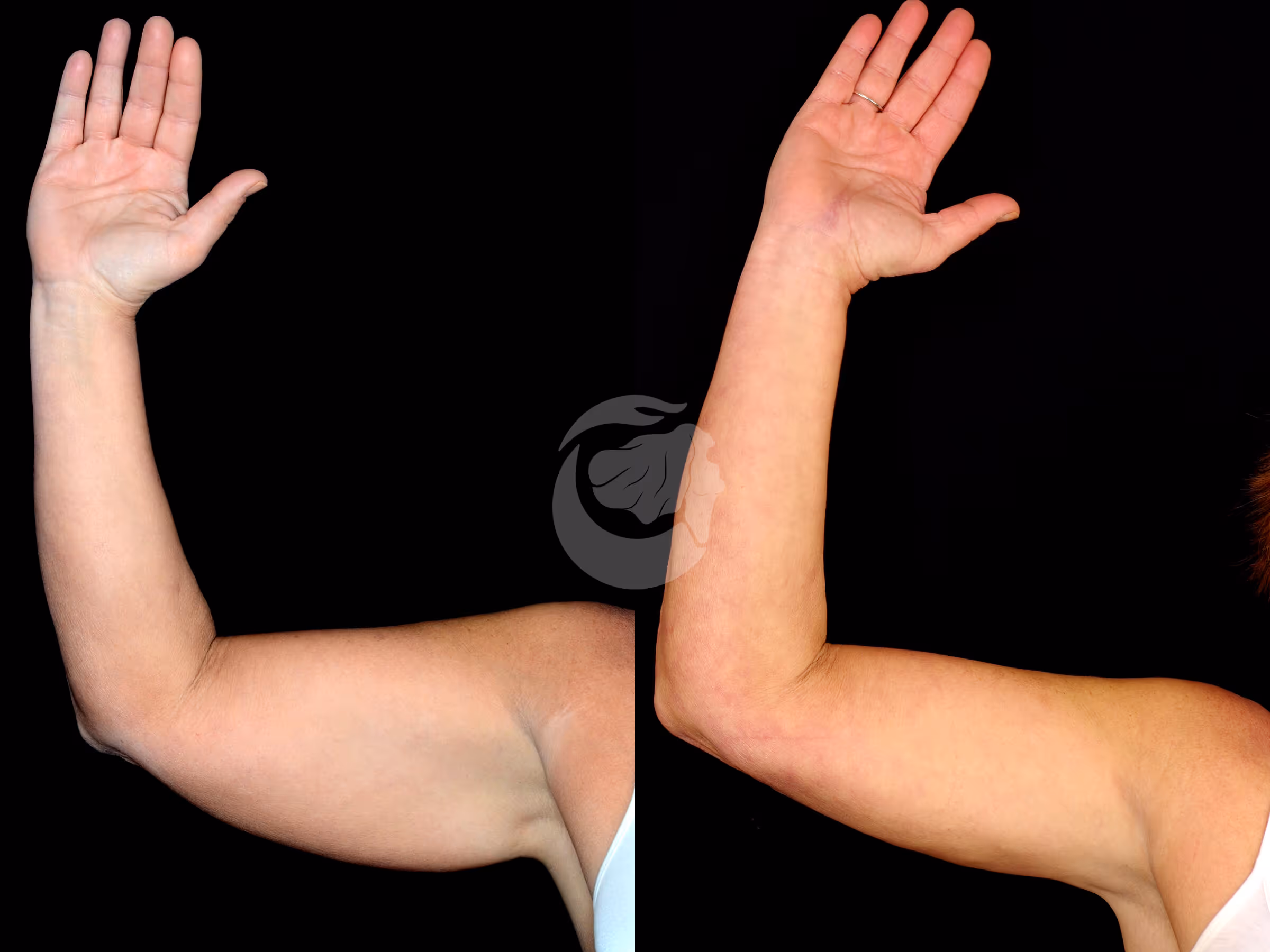 Before And After Patient Image