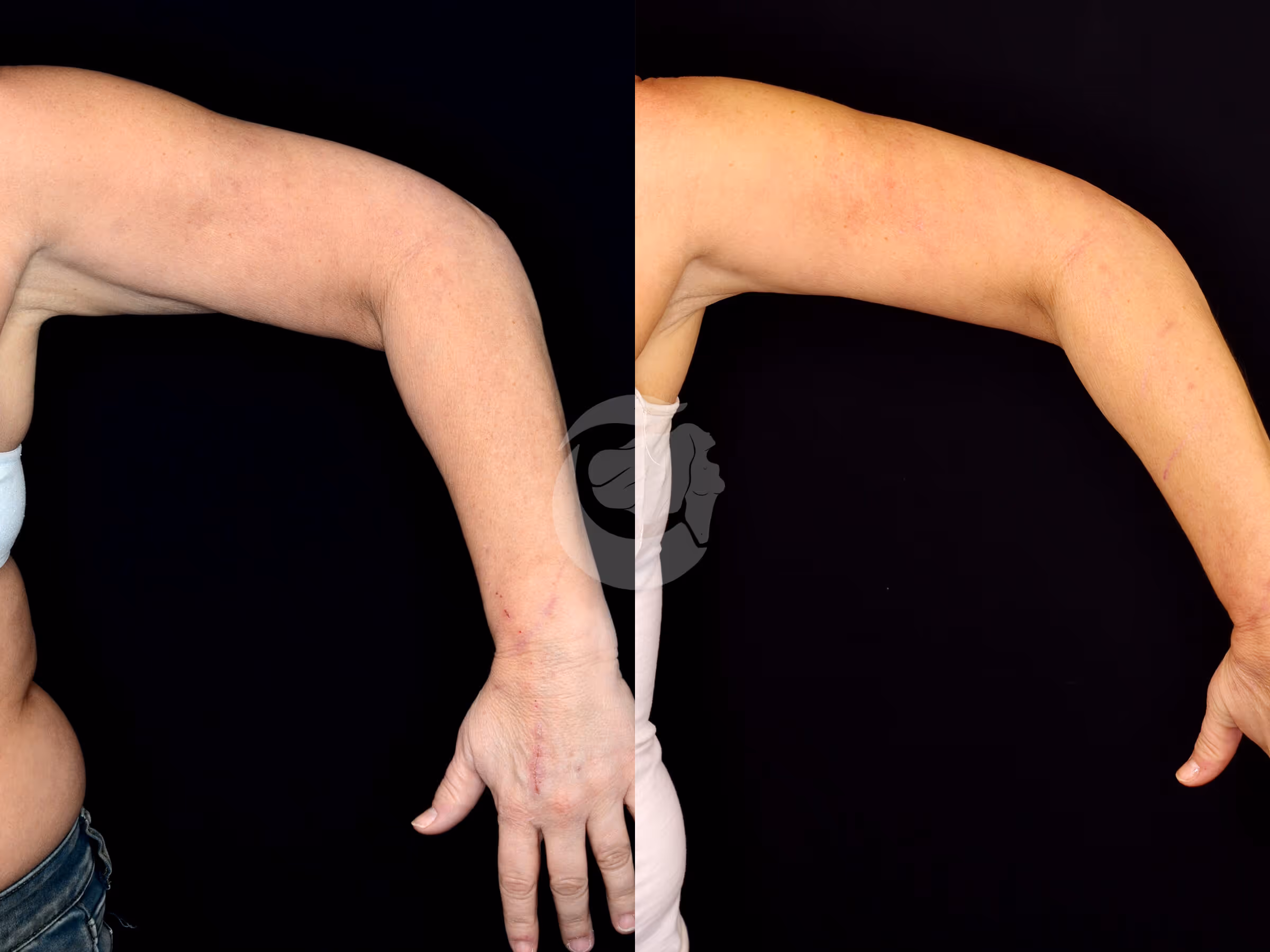 Before And After Patient Image