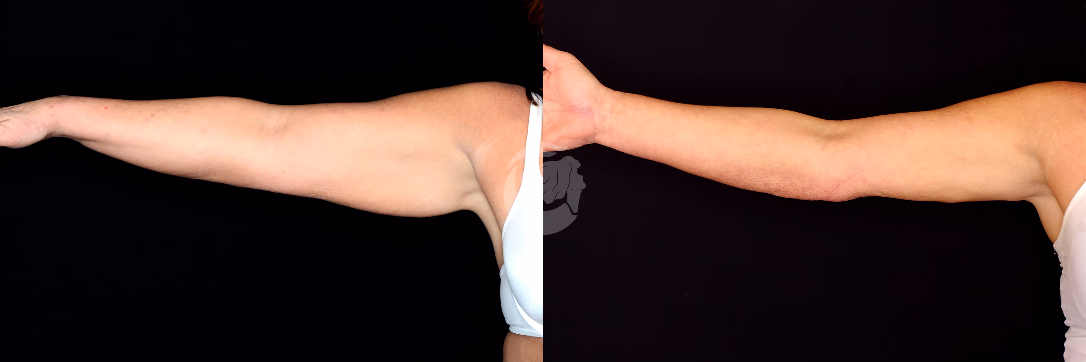 Before And After Patient Image