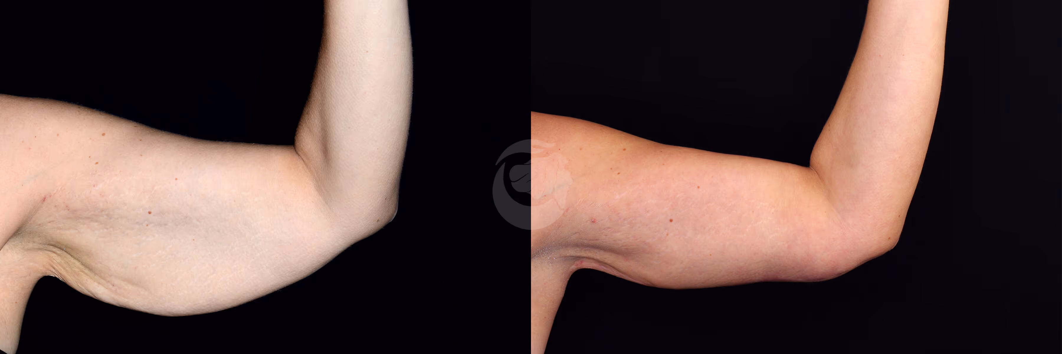 Before And After Patient Image
