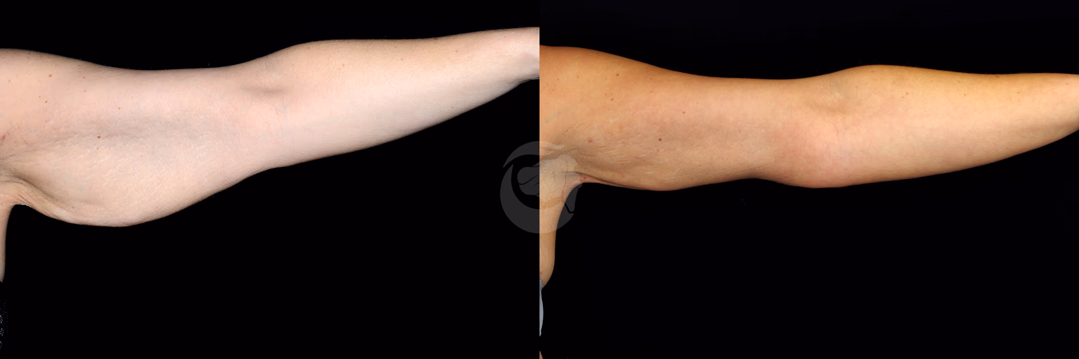 Before And After Patient Image