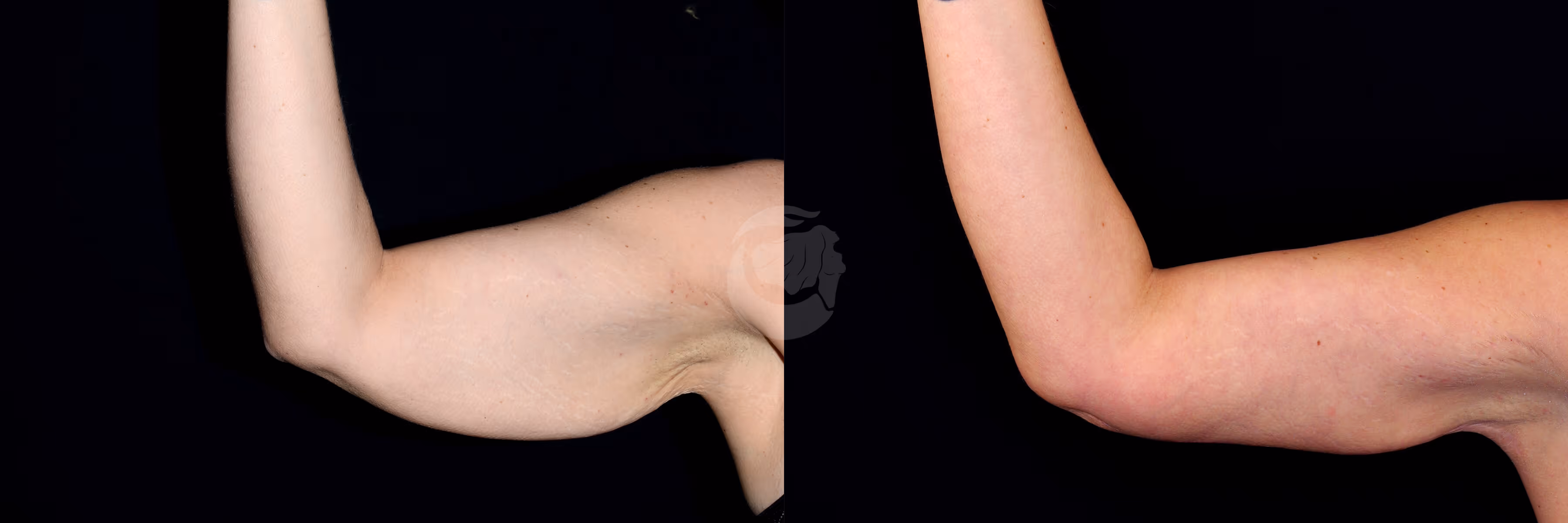 Before And After Patient Image